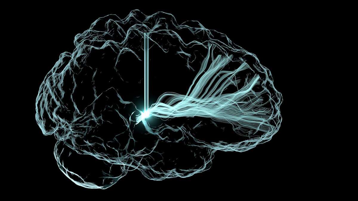 Electrical activity in a brain