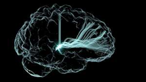Electrical activity in a brain