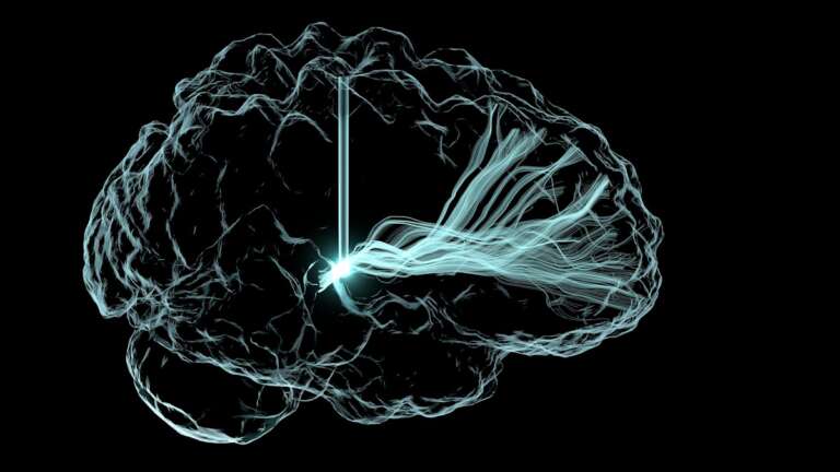 Electrical activity in a brain